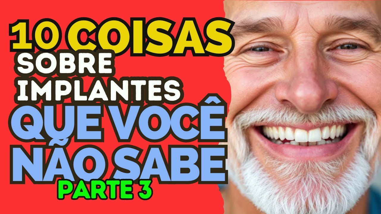 10 Segredos sobre Implantes que os dentistas costumam esconder (Parte 3).