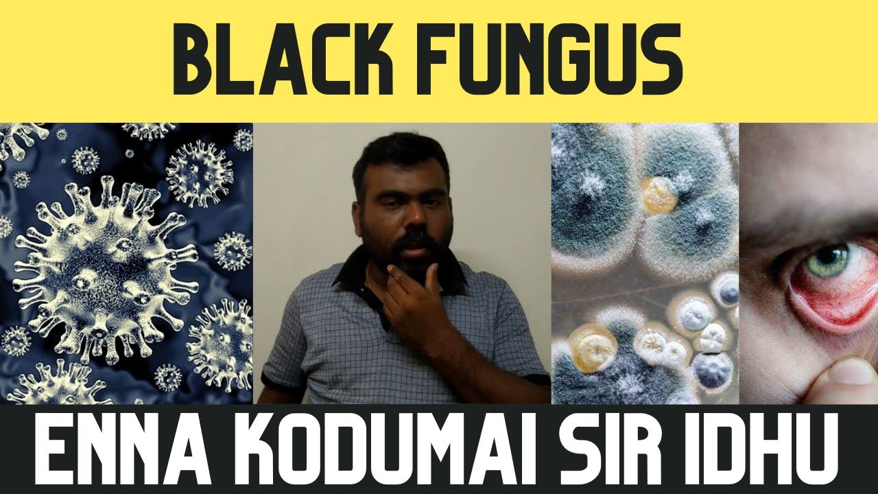 Black Fungus Covid19 Secondary Infection Amphotericin B Tamil