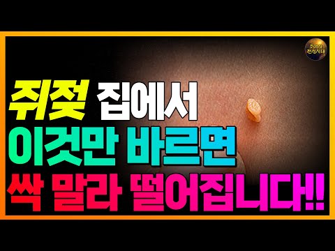 쥐젖 싹 없어집니다!! 돈 들이지 말고 집에 있는 이것 발라보세요!!