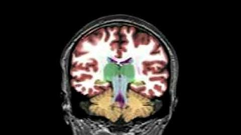 Volumetric images of the entire brain in a coronal orientation