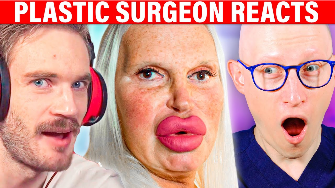 PewDiePie on BOTCHED Plastic Surgery | Surgeon Reacts