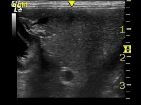 Canine ultrasonography: following the gastroduodenal vein back from portal vein into pancreas