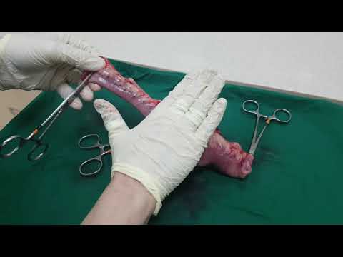वीडियो: कुत्तों में आंतों के ट्यूमर (अपुडोमास)