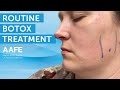 Routine Botox Treatment | AAFE