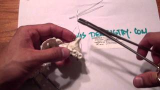Mandible Fracture - Ivy Loop Fixation - Maxilla Kitchen Table.MP4