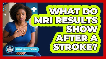 What Do MRI Results Show After A Stroke? - Stroke Support Channel