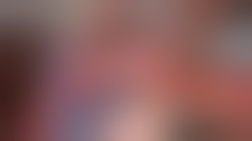 Robotic TOTAL GASTRECTOMY D2 Plus Lymphadenectomy – Step-by-Step Surgical Technique - G. PIGNATA