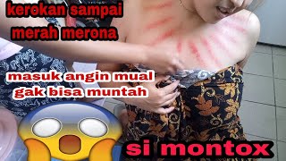 VLOG TKW HONGKONG || Kerokan dada wanita terbaru part 2 || kerokan obat tradisional