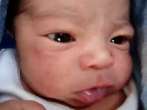 porque tiene los ojos amarillos un recien nacido