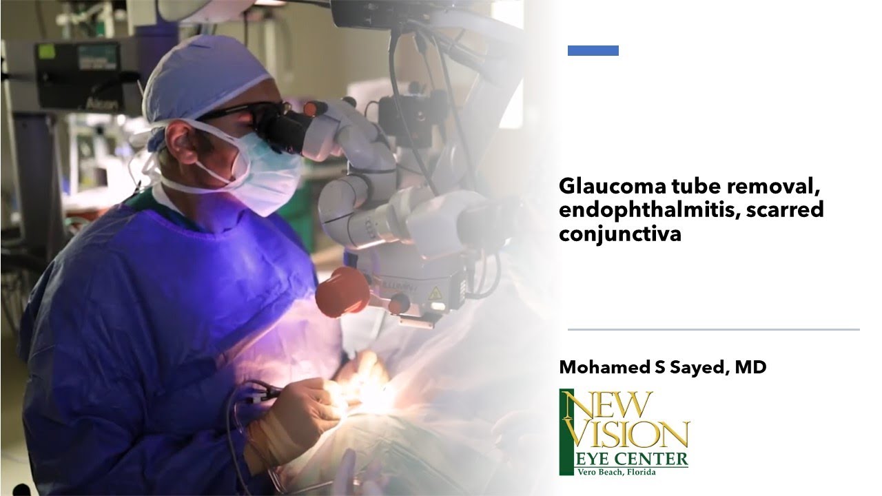 tube exposure, endophthalmitis, scarred conjunctiva, tube