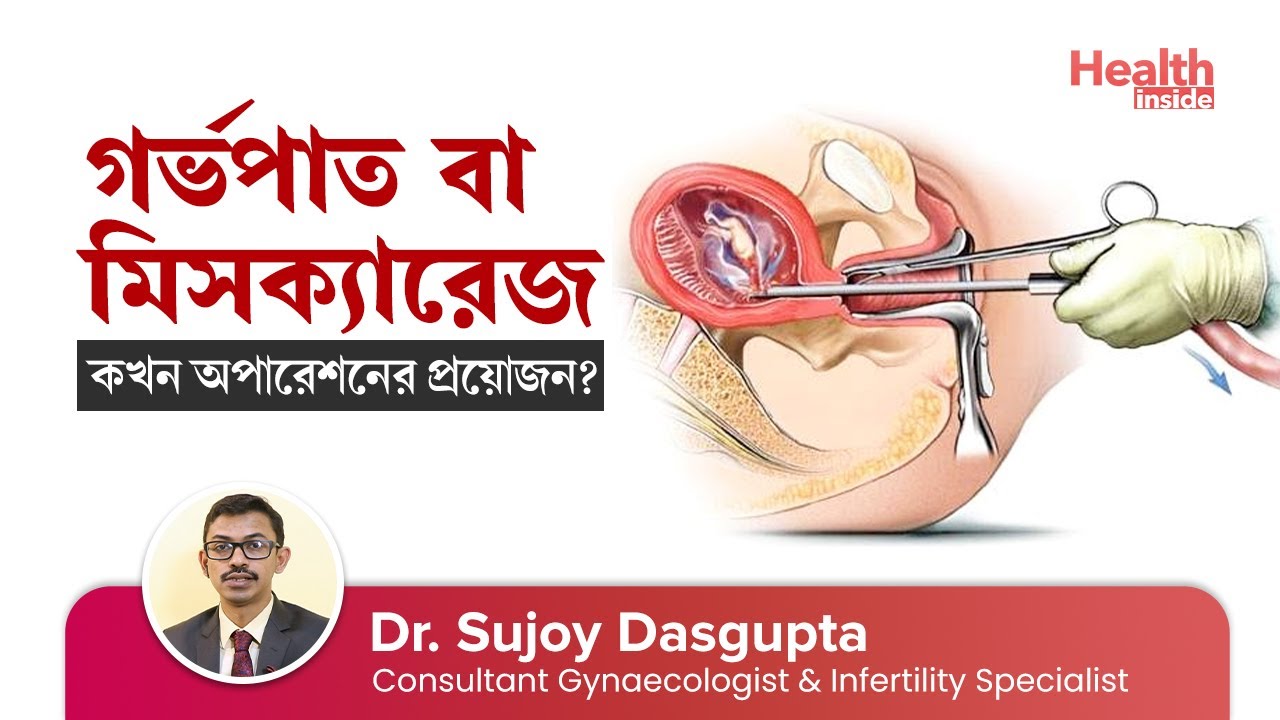 Porno starpon xotini Juda chiroyli etuk porno