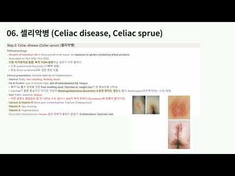 KMLE 강의 시리즈 - Gastroenterology, 9) 흡수장애 질환 (흡수장애 2)