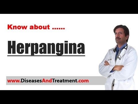 Herpangina : Causes, Diagnosis, Symptoms, Treatment