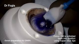 Details Donor DM preparation for DMEK using air bubble assisted marking and CL assisted donor punch Update