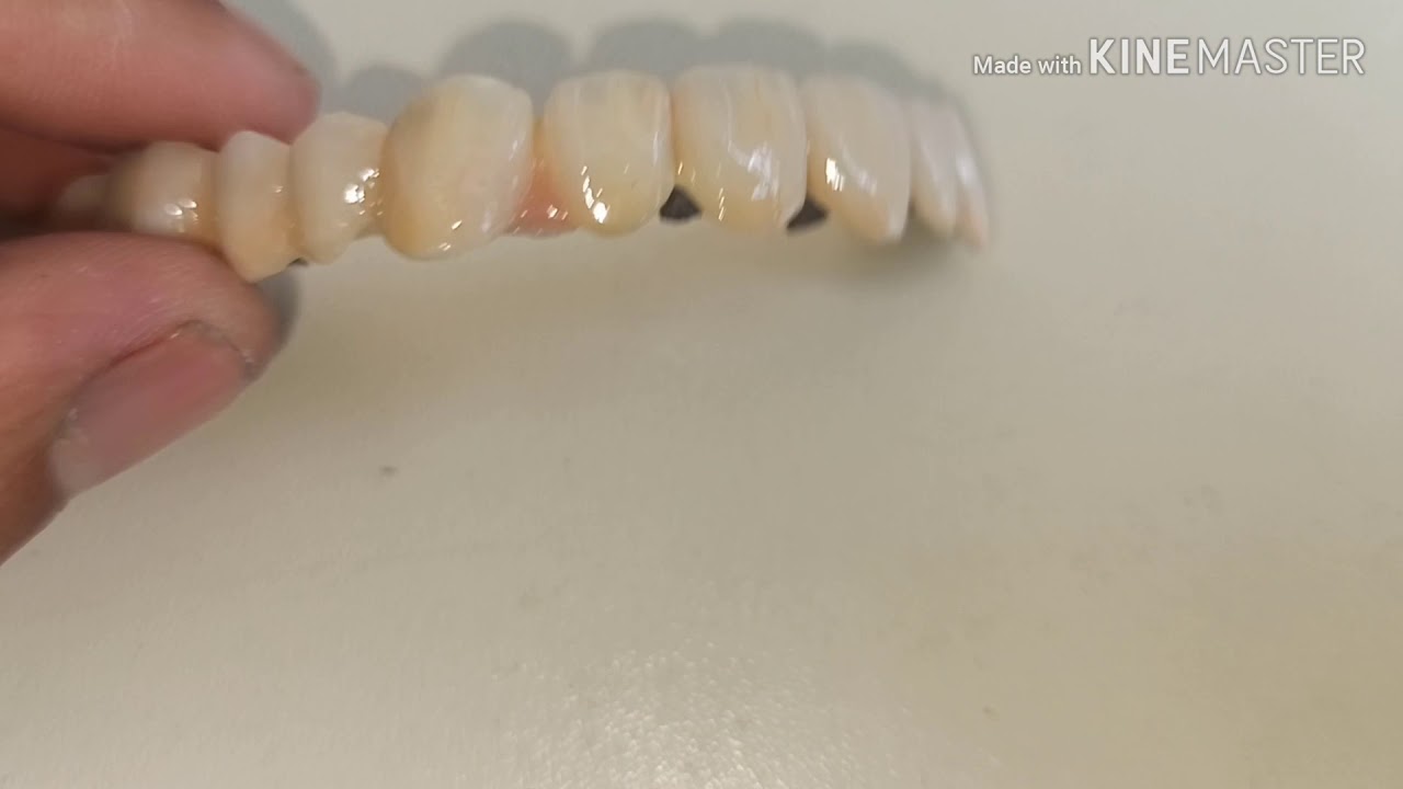 IPS Style Ceram - YouTube