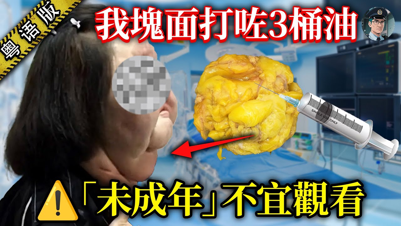 10年整容上百次！韓國model從神似王祖賢到「電扇頭」，塊面取出3.5公斤矽膠異物，佢嘅經歷令整容業震驚！【鐘sir講案】韓國案件 韓國財閥 案件解說