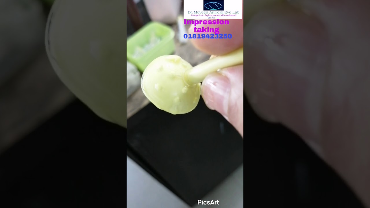 Top Artificial Eye Lab in Bangladesh