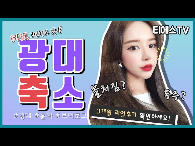 (Eng sub)#광대축소 3개월이면 #윤곽붓기 다 빠지나여? 성형외과 코디가 직접 겪은 윤곽후기! #광대축소술 #자연유착 #듀얼트임 성형브이로그 / 티에스성형외과