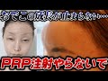 【PRP注射の数年後の危険性について】おでこを丸くしたら最悪な結果になりました…