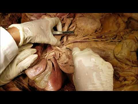 Portal Vein Formation-High Definition Demonstration and Clinical Correlations – Sanjoy Sanyal