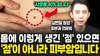 지금 여러분 몸에 이렇게 생긴 '점'이 있다면 '피부암'입니다 (심현철 원장 / 4부)