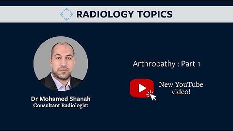 Arthropathy - Dr Mohamed Shanah