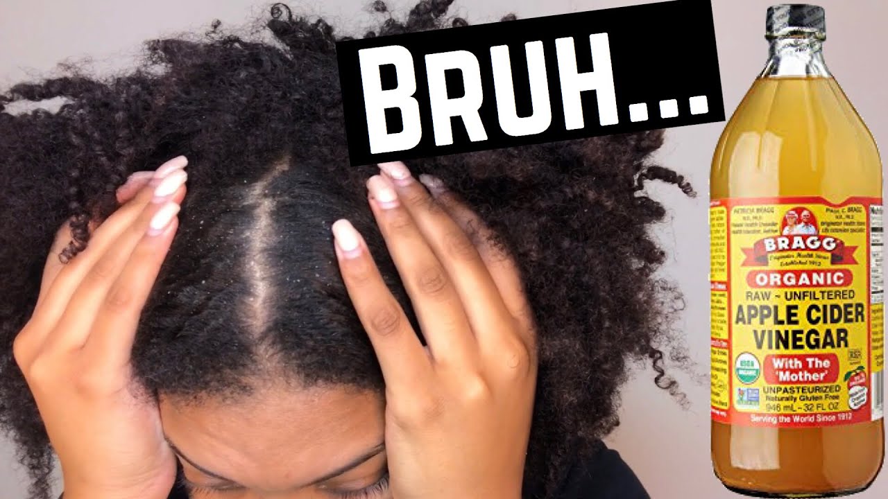 How To Get Rid Of Dry Flaky Scalp Acv Rinse Tutorial Natural