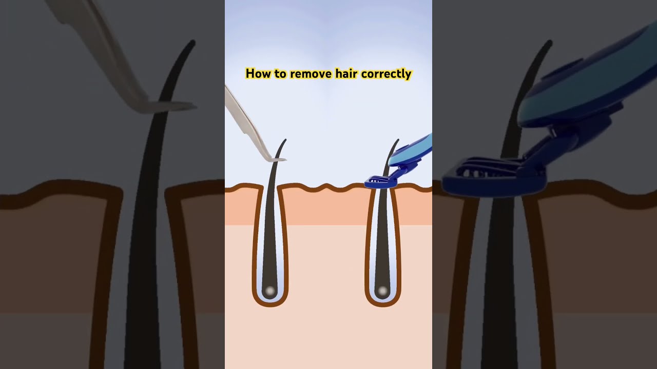Laser Hair Removal Can Penetrate Deep Into The Follicles Which Inhibit Growth