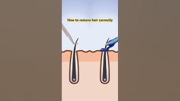 Laser hair removal can penetrate deep into the hair follicles, which can inhibit hair growth#hair