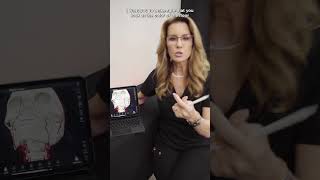 Anatomy + Safety: Injecting The Chin