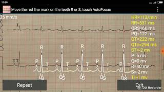 ECG reader using smartphone camera screenshot 3