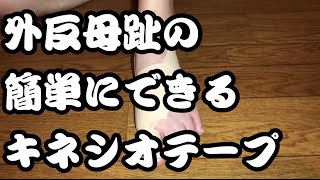 100均で買えるテーピングでも巻ける外反母趾セルフテーピング