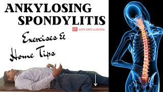 7 Best Ankylosing Spondylitis Exercises to prevent joint stiffness & muscle tightness