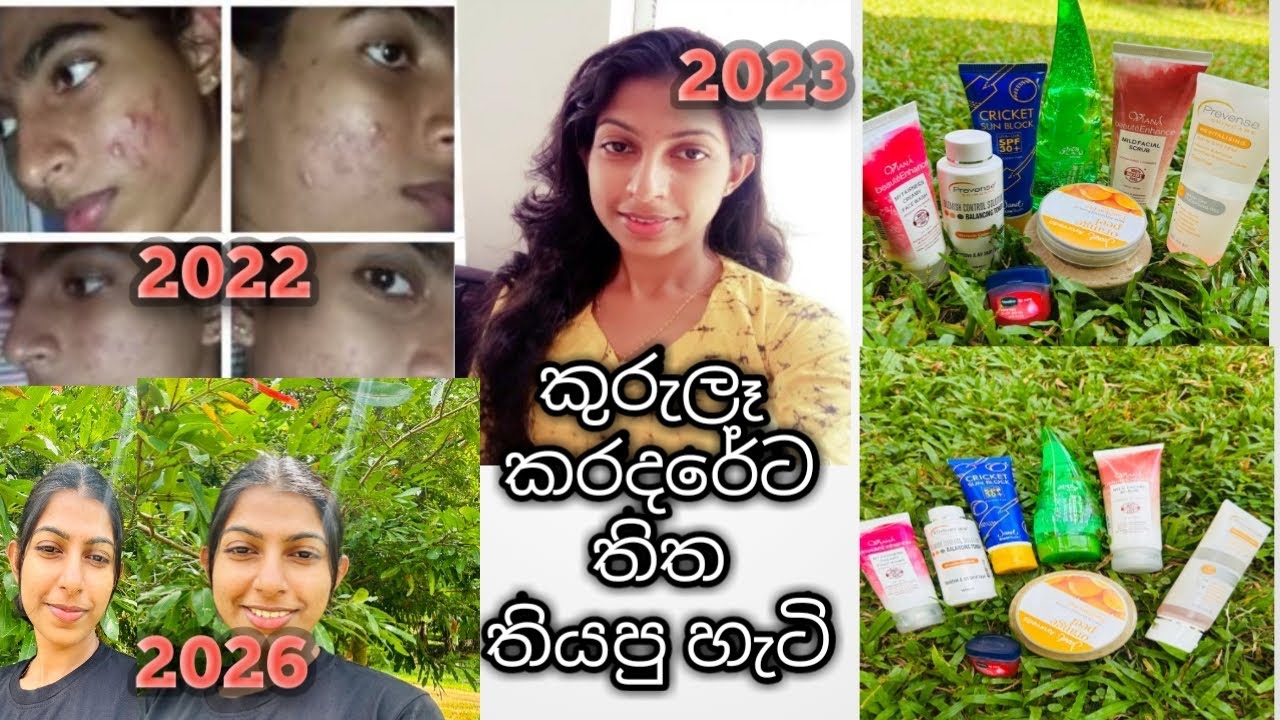 කාලයක් තිස්සේ වද දීපු pimples කරදරේ මම ඉවර කරගත්තේ මේ products භාවිතා කරලා 🥹😍