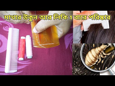 ভিডিও: বেরেজনিকি কীভাবে যাবেন