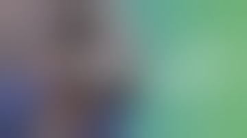 Recorded Cataract Surgery by Dr. Vincent Qin - HASA OPTIX