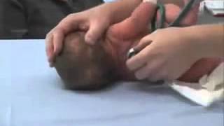 Newborn Examination: Auscultation of the lungs‬ Update