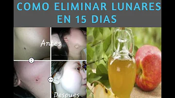 ¿Cómo puedo eliminar lunares profundos de la cara de forma natural?