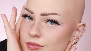 Things You Wouldn’t Know About Having Alopecia