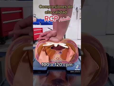 Compresiones en RCP