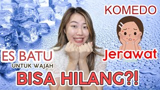 Wajib Ditonton!! Cara memudarkan Flek hitam dan bekas jerawat yang membandel