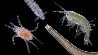 What Hides In Your Trunks After A Swim In The Ocean? - Under The Microscope