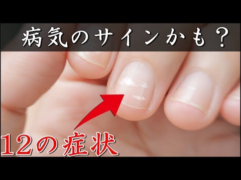 【雑学】爪に縦の線があると・・・ 爪を見るだけで健康状態が分かる！この12の症状は病気のサイン？