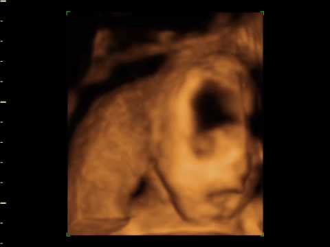 nicky clarke tiesintuvas Baby of Nicky and Grant