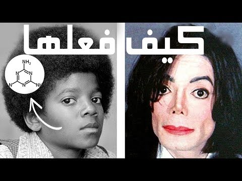 كيف غير مايكل جاكسون لون جلده