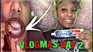 VLOGMAS DAY 2..... HOW TO BRUSH YOUR TEETH 🦷 WITH BRACES