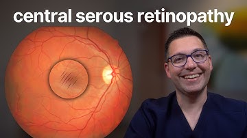 Central Serous Retinopathy: What You Need to Know