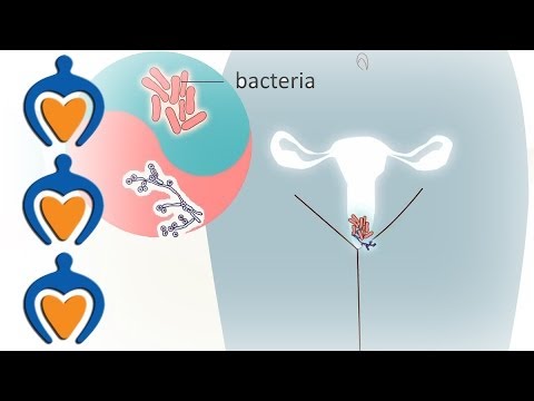 योनि खमीर संक्रमण - यह क्या है और इसका इलाज कैसे किया जाता है?