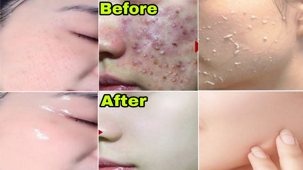 Face, Body, Private parts cleansing scrub gel review in hindi Ashu