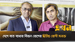 বিশ্বের এমন ৪০০ রোগীর সুরক্ষায় চলছে গবেষণা | Aplar Congress 2025 | Arthritis patient | Ekhon TV